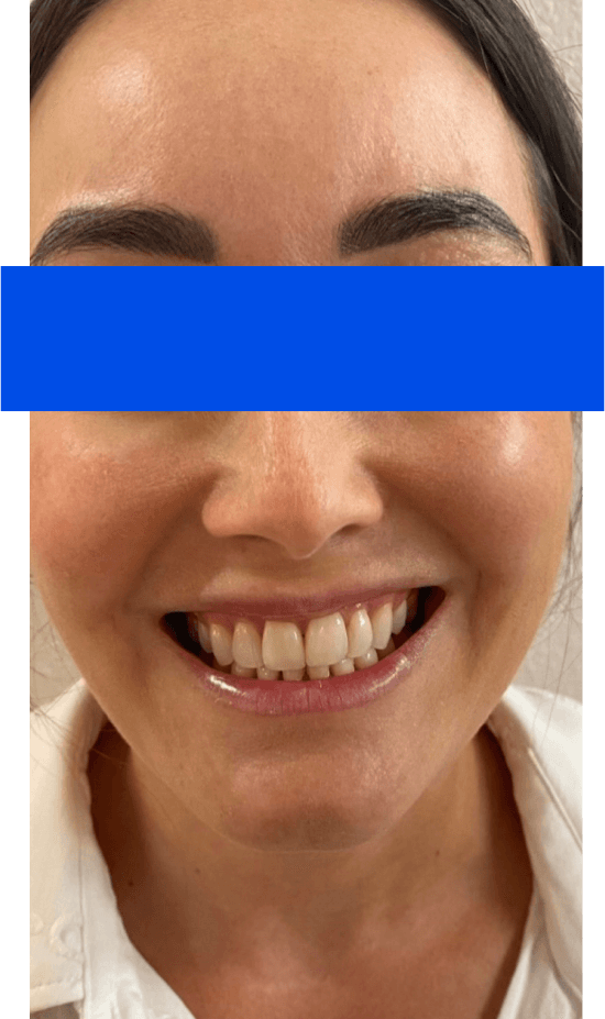 Sourire avant le traitement