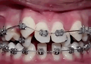 Orthodontie